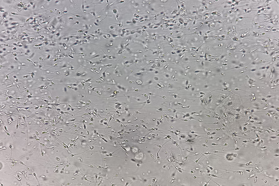 Sperm analysis on microscopic examination, Normozoospermia, norm
