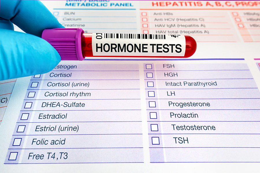 Blood sample for study of levels of hormone tests